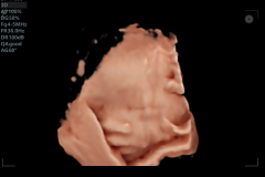 สำเนาของ-สำเนาของ-สำเนาของ-IMG_6295