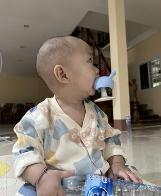 วัยรุ่นคันฟัน